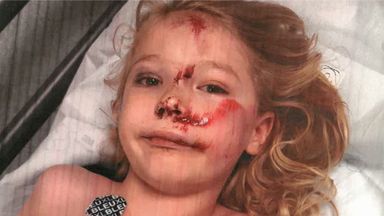 Six-year-old Jamie Smith suffered a fractured skull after being hit by an e-scooter rider. Pic: Leicestershire Police